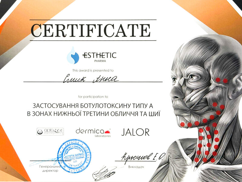 Сертифікат Анни Смик про застосування ботулотоксину типу А в зонах нижньої третини обличчя та шиї