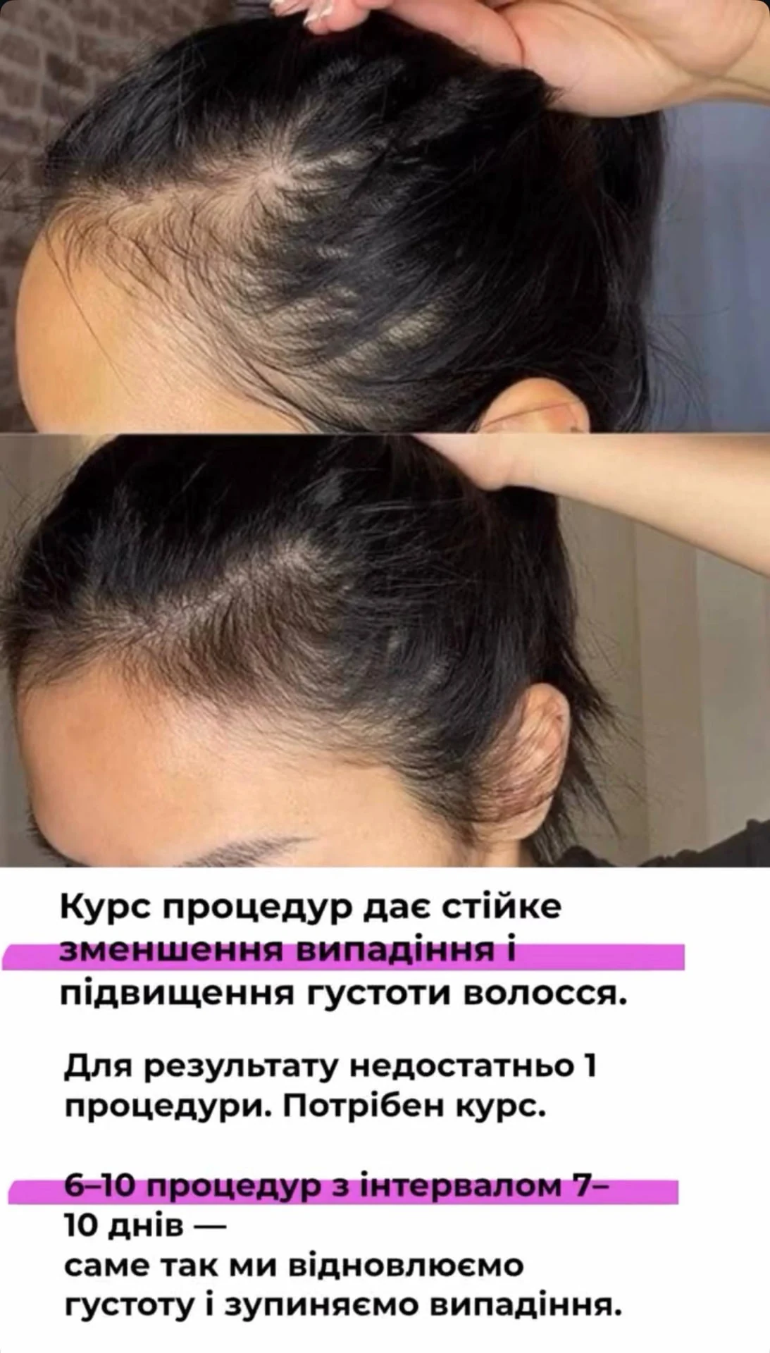 Комплексний підхід до курсу процедур